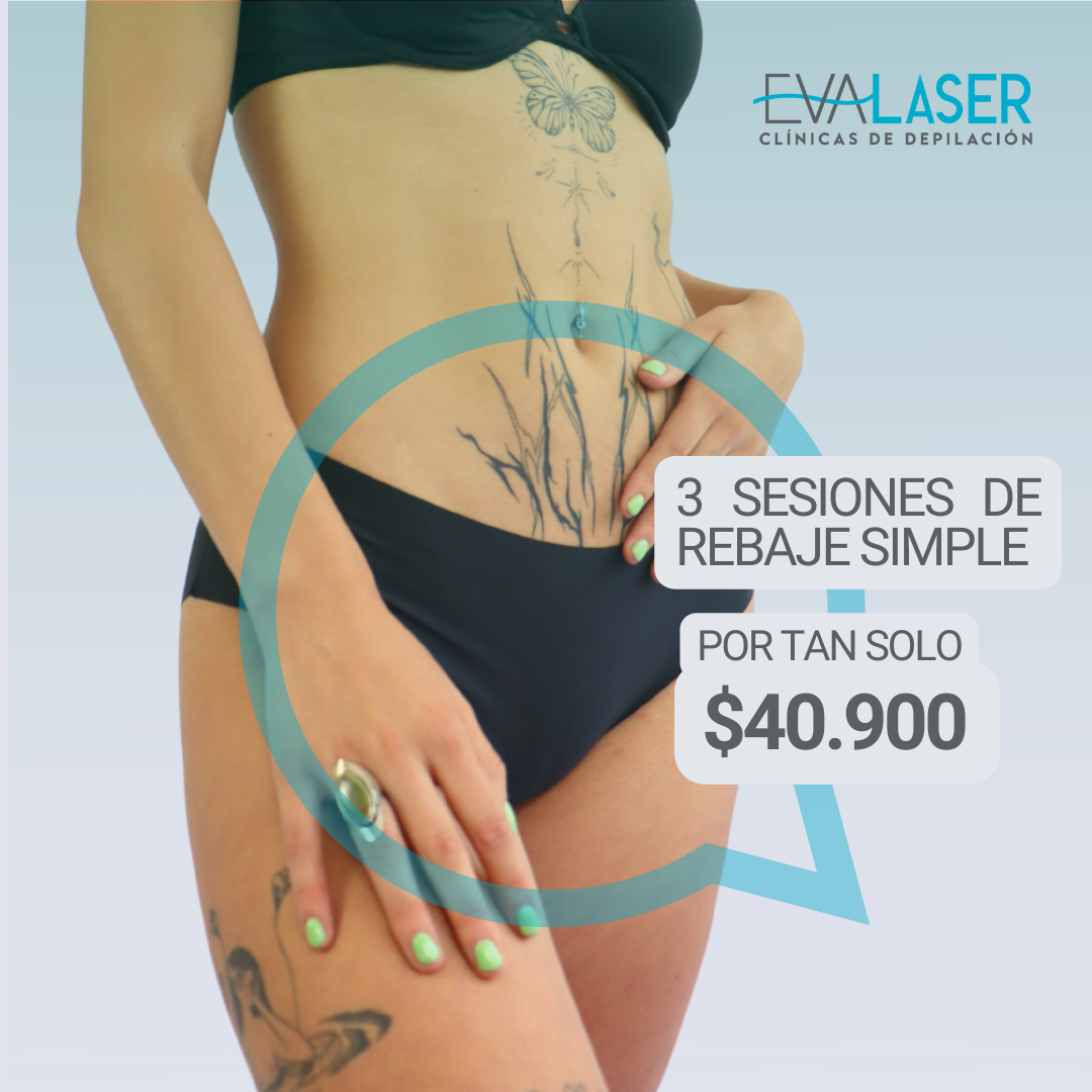 DEPILACIÓN LÁSER REBAJE SIMPLE 3 SESIONES