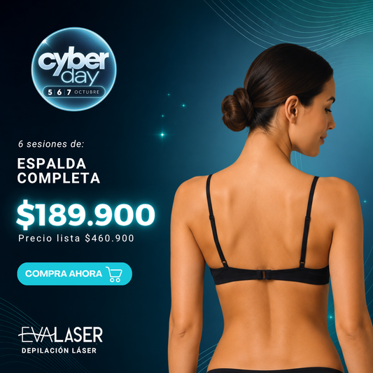 Depilación Láser: Espalda Completa