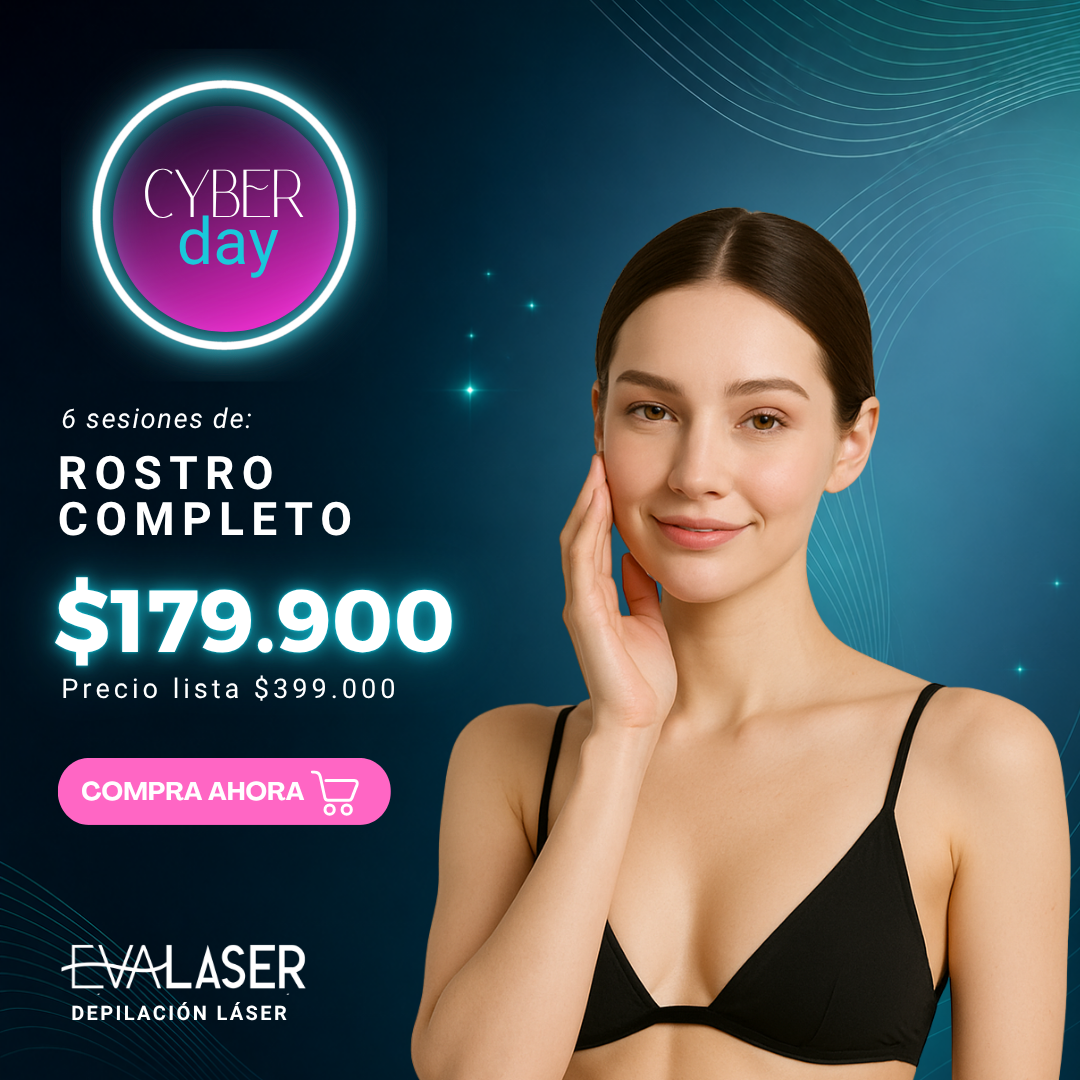 Depilación Láser: Rostro completo